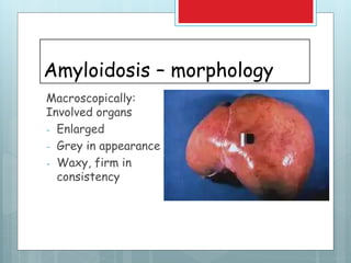 Amyloidosis – morphology
Macroscopically:
Involved organs
- Enlarged
- Grey in appearance
- Waxy, firm in
consistency
 