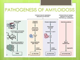 AMYLOIDOSIS pathology pptx ssr medical college | PPTX