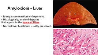 AMYLOIDOSIS ,it's classification and pathogenesis.pdf