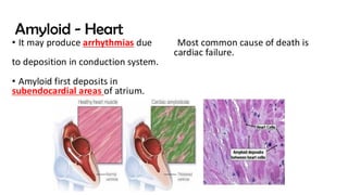 AMYLOIDOSIS ,it's classification and pathogenesis.pdf