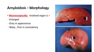 AMYLOIDOSIS ,it's classification and pathogenesis.pdf