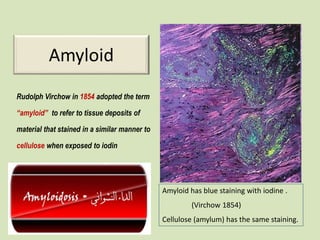 Amyloid
Rudolph Virchow in 1854 adopted the term
“amyloid” to refer to tissue deposits of
material that stained in a similar manner to
cellulose when exposed to iodin
Amyloid has blue staining with iodine .
(Virchow 1854)
Cellulose (amylum) has the same staining.
 