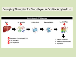 Emerging Therapies for Transthyretin Cardiac Amyloidosis
 