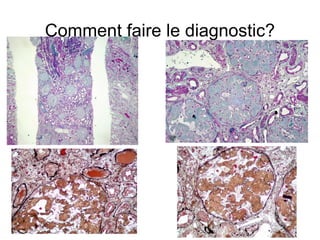 Comment faire le diagnostic? 