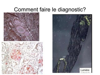 Comment faire le diagnostic? 