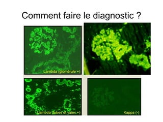Comment faire le diagnostic ? 
