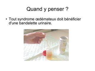 Quand y penser ? Tout syndrome œdémateux doit bénéficier d'une bandelette urinaire. 