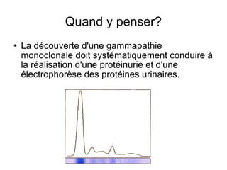 Quand y penser? La découverte d'une gammapathie monoclonale doit systématiquement conduire à la réalisation d'une protéinurie et d'une électrophorèse des protéines urinaires. 