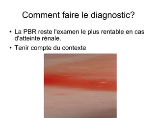 Comment faire le diagnostic? La PBR reste l'examen le plus rentable en cas d'atteinte rénale. Tenir compte du contexte 