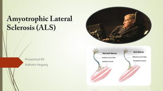Amyotrophic Lateral
Sclerosis (ALS)
Presented BY:
Adham Hegazy
 
