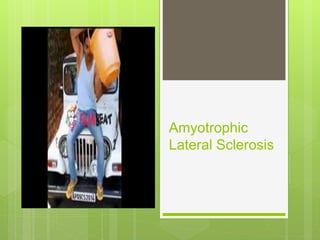 Amyotrophic 
Lateral Sclerosis 
 