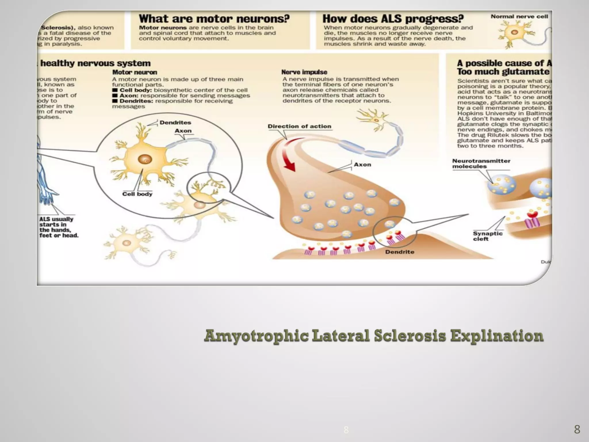 Amyotrophic Lateral Sclerosis | PPT