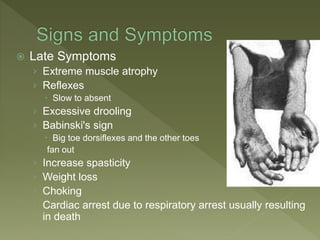  Late Symptoms
› Extreme muscle atrophy
› Reflexes
 Slow to absent
› Excessive drooling
› Babinski's sign
 Big toe dorsiflexes and the other toes
fan out
› Increase spasticity
› Weight loss
› Choking
› Cardiac arrest due to respiratory arrest usually resulting
in death
 