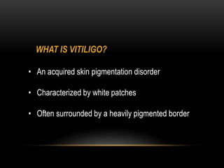 WHAT IS VITILIGO?
• An acquired skin pigmentation disorder
• Characterized by white patches
• Often surrounded by a heavily pigmented border
 