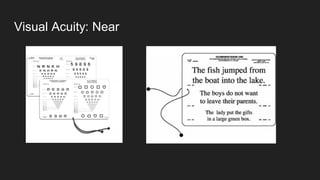 Visual Acuity: Near
 