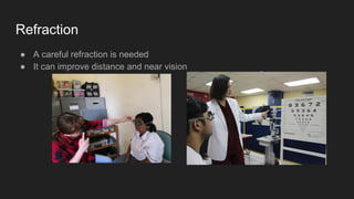 Refraction
● A careful refraction is needed
● It can improve distance and near vision
 