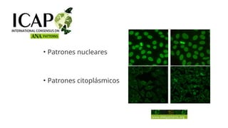 Comprehensive Overview of Anti-Nuclear Antibodies in Autoimmune Disease ...