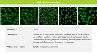 Comprehensive Overview of Anti-Nuclear Antibodies in Autoimmune Disease ...