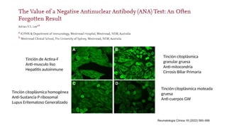 Comprehensive Overview of Anti-Nuclear Antibodies in Autoimmune Disease ...