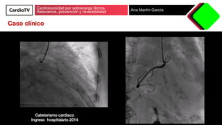 Cardiotoxicidad por sobrecarga férrica.
Relevancia, prevención y reversibilidad Ana Martín García
Cateterismo cardiaco!
In...