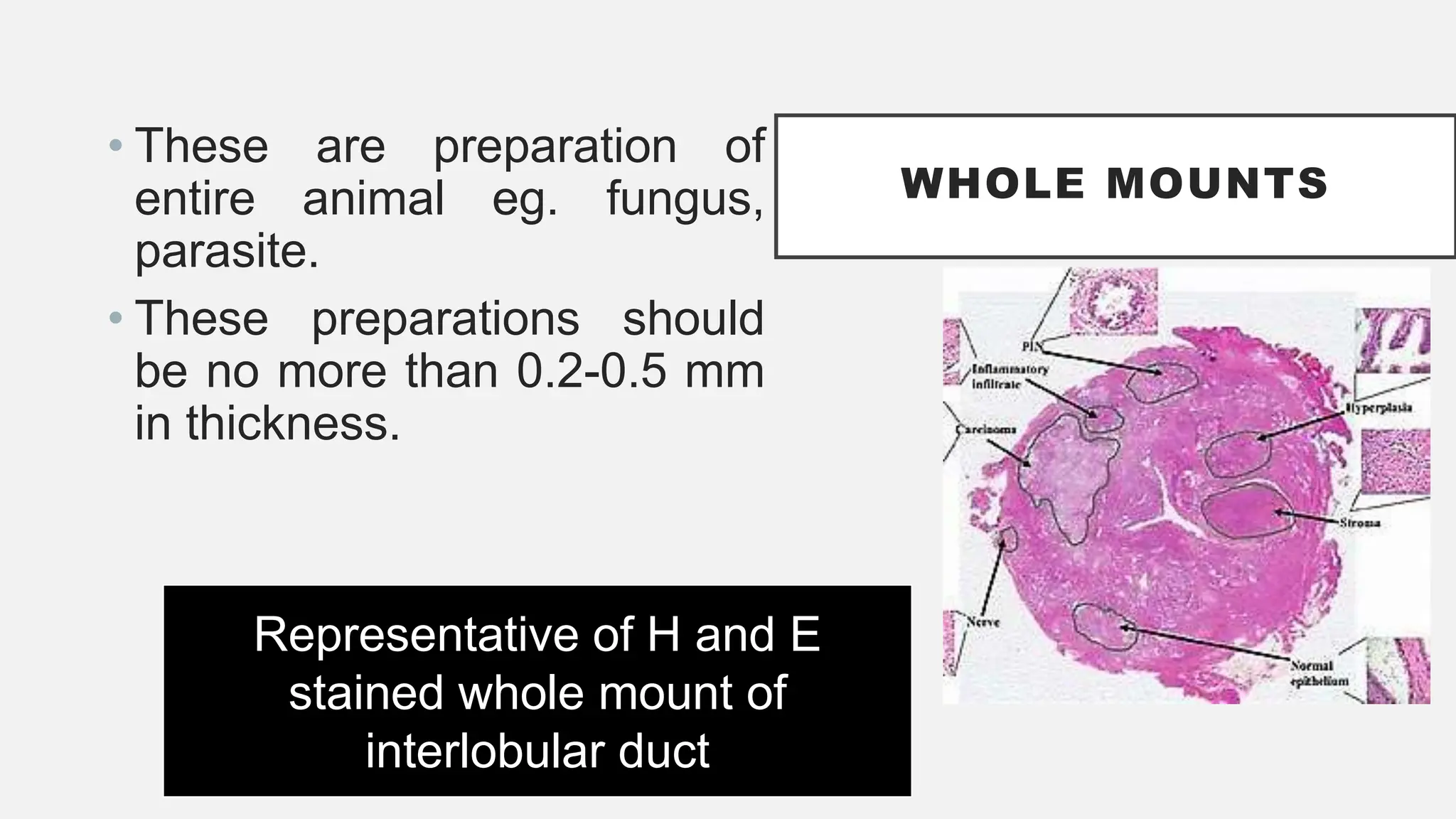 WHOLE MOUNTS
• These are preparation of
entire animal eg. fungus,
parasite.
• These preparations should
be no more than 0.2-0.5 mm
in thickness.
Representative of H and E
stained whole mount of
interlobular duct
 
