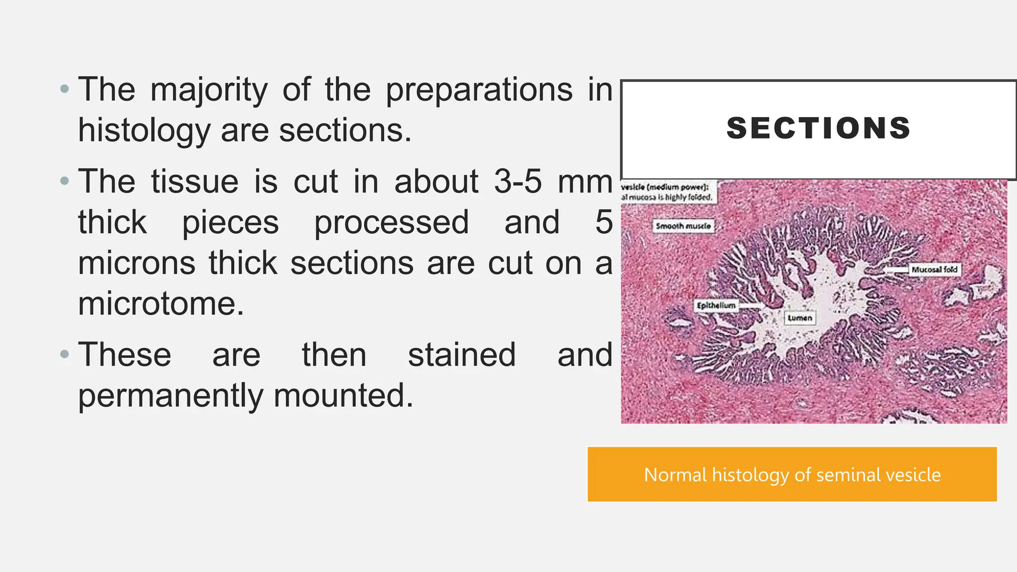SECTIONS
• The majority of the preparations in
histology are sections.
• The tissue is cut in about 3-5 mm
thick pieces processed and 5
microns thick sections are cut on a
microtome.
• These are then stained and
permanently mounted.
Normal histology of seminal vesicle
 