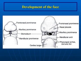 Ana_6_Development of the face. anatomy geneticsppt | PPT