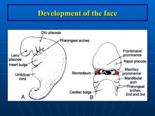 Ana_6_Development of the face. anatomy geneticsppt | PPT