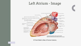 Topographic and Applied Anatomy of the Heart | PDF