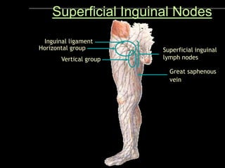 Great saphenous
vein
Superficial inguinal
lymph nodes
Vertical group
Horizontal group
Superficial Inguinal Nodes
Inguinal ligament
 