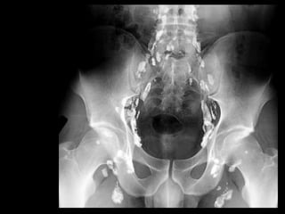 ANA809Lymphatic System lim pics.ppt