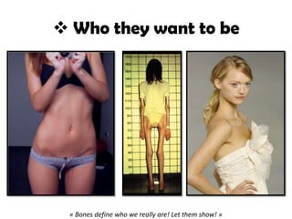 Who they want to be
« Bones define who we really are! Let them show! »
 