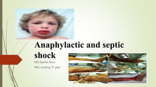 Anaphylactic and septic
shock
MD Danish Rizvi
MSc nursing 1st year
 