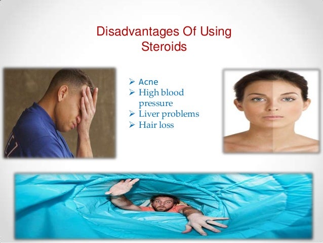 Know About The Best Place Where To Buy Steroids