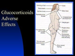 Glucocorticoids Adverse Effects 