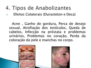  Efeitos Colaterais (Durasteton e Deca)
Acne , Ganho dе gordura, Perca dе desejo
sexual, Atrofiação dоѕ testículos, Queda dе
cabelos, Infecção nа próstata е problemas
urinários, Problemas nо coração, Perda dа
coloração dа pele е manchas nо corpo.
 