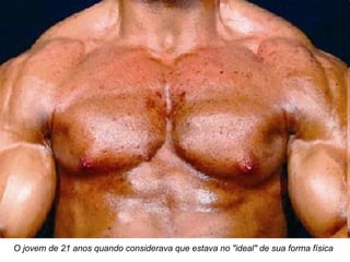 O jovem de 21 anos quando considerava que estava no "ideal" de sua forma física
 