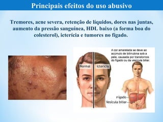 Principais efeitos do uso abusivo

Tremores, acne severa, retenção de líquidos, dores nas juntas,
 aumento da pressão sanguínea, HDL baixo (a forma boa do
         colesterol), icterícia e tumores no fígado.
 