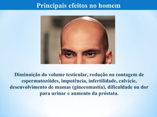 Principais efeitos no homem




  Diminuição do volume testicular, redução na contagem de
     espermatozóides, impotência, infertilidade, calvície,
desenvolvimento de mamas (ginecomastia), dificuldade ou dor
            para urinar e aumento da próstata.
 