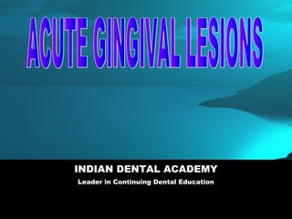INDIAN DENTAL ACADEMY
    Leader in Continuing Dental Education


www.indiandentalacademy.com
 