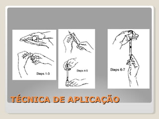 TÉCNICA DE APLICAÇÃO 