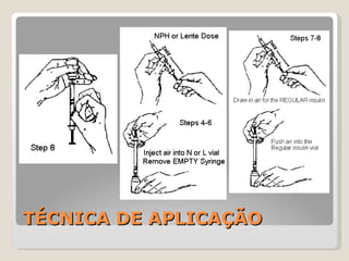 TÉCNICA DE APLICAÇÃO 