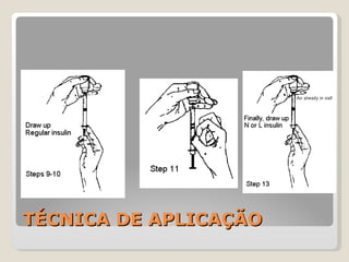 TÉCNICA DE APLICAÇÃO 