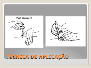TÉCNICA DE APLICAÇÃO 