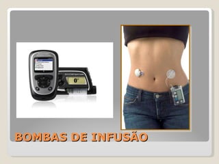 BOMBAS DE INFUSÃO 