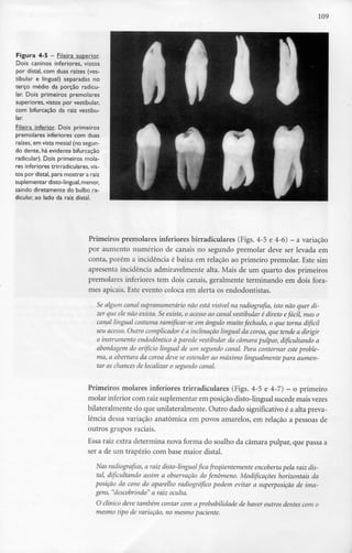 109
Figura 4-5 - Fileira superior.
Dois caninos inferiores, vistos
por distai,com duas raízes(ves-
tibular e lingual) separadas no
terço médio da porção radicu-
lar. Dois primeiros premolares
superiores, vistos por vestibular,
com bifurcação da raiz vestibu-
lar.
Fileira inferior. Dois primeiros
premolares inferiores com duas
raízes, em vista mesial (no segun-
do dente,há evidente bifurcação
radicular). Dois primeiros mola-
res inferiores trirradiculares, vis-
tos por distai, para mostrar a raiz
suplementar disto-lingual,menor,
saindo diretamente do bulbo ra-
dicular, ao lado da raiz distai.
Primeiros premolares inferiores birradiculares (Figs. 4-5 e 4-6) - a variação
por aumento numérico de canais no segundo premolar deve ser levada em
conta, porém a incidência é baixa em relação ao primeiro premolar. Este sim
apresenta incidência admiravelmente alta. Mais de um quarto dos primeiros
premolares inferiores tem dois canais, geralmente terminando em dois fora-
mes apicais. Este evento coloca em alerta os endodontistas.
Se algum canal supranumerário não está visível na radiografia, isto não quer di-
zer que ele não exista. Se existe, o acesso ao canal vestibular é direto efácil, mas o
canal lingual costuma ramificar-se em ângulo muito fechado, o que torna difícil
seu acesso. Outro complicador é a inclinação lingual da coroa, que tende a dirigir
o instrumento endodôntico à parede vestibular da câmara pulpar, dificultando a
abordagem do orifício lingual de um segundo canal. Para contornar este proble-
ma, a abertura da coroa deve se estender ao máximo lingualmente para aumen-
tar as chances de localizar o segundo canal.
Primeiros molares inferiores trirradiculares (Figs. 4-5 e 4-7) - o primeiro
molar inferior com raizsuplementar em posição disto-lingualsucedemais vezes
bilateralmente do que unilateralmente. Outro dado significativo é a alta preva-
lência dessa variação anatómica em povos amarelos, em relação a pessoas de
outros grupos raciais.
Essa raiz extra determina nova forma do soalho da câmara pulpar, que passa a
ser a de um trapézio com base maior distai.
Nas radiografias, a raiz disto-lingual fica frequentemente encoberta pela raiz dis-
tai, dificultando assim a observação do fenómeno. Modificações horizontais da
posição do cone do aparelho radiográfico podem evitar a superposição de ima-
gens, "descobrindo" a raiz oculta.
O clínico deve também contar com a probabilidade de haver outros dentes com o
mesmo tipo de variação, no mesmo paciente.
 