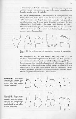 13
A única exceçao na dentição* permanente é o primeiro molar superior e na
dentição decídua, é o segundo molar superior. Em ambos o tamanho da face
lingual predomina sobre o da vestibular.
Face mesial maior que a distai - em consequência da convergência das faces
livres para a distai, a face mesial possui dimensões maiores do que a face
distai em um dente sem desgaste ou pouco desgastado. Neste caso, a face
mesial esconde o resto da coroa, mas a vista distai inclui partes das faces
vizinhas (Fig. 1-13). Além disso, a face mesial é mais alta que a face distai.
O incisivo central inferior, que tem uma coroa simétrica, não exibe este caráter
distintivo com exuberância. No primeiro premolar inferior,a face mesial é ge-
ralmente menos alta que a distai.
Figura 1-13 - Coroas dentais vistas pela face distai, com o contorno da face mesial ao
fundo.
Face mesial plana e reta e face distai convexa e curva (Figs. 1-14 e 1-15) - por
ser menor, com seus limites próximos um do outro, a face distai apresenta-se
mais convexa, mais abaulada, tanto em visão frontal quanto de perfil. O abau-
lamento deixa a distai mais inclinada, de tal modo a formar com a raiz uma
angulação que inexiste (ou é menor) no lado mesial. Não obstante, deve-se
descontar a inclinação distai da raiz, que faz aumentar a angulação. Essa as-
sertiva é comprovada quando se examina incisivos, caninos e molares por ves-
tibular. Nos premolares este detalhe é menos marcado.
Figura 1-14 - Coroas dentais
vistas pela face vestibular para
mostrar a borda corresponden-
te à face mesial (traço espesso)
mais alta que a distai.
Figura 1-15 - Coroas dentais
vistas pela face vestibular para
mostrar a borda distai forman-
do ângulo com o contorno da
raiz (traço espesso). O ângulo
correspondente do lado mesial
é menos pronunciado.
 