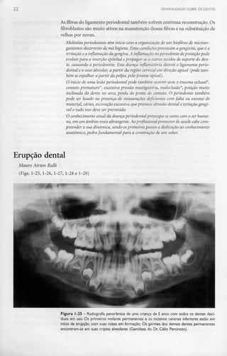 GENERALIDADES SOBRE OS DENTES
As fibras do ligamento periodontal também sofrem contínua reconstrução. Os
fibroblastos são muito ativos na manutenção dessas fibras e na substituição de
velhas por novas.
Moléstias perlodontais têm início com a organização de um biofilme de microor-
ganismos decorrente de má higiene. Estascondiçõesprovocam a gengivite, que é a
irritação e a inflamação da gengiva.A inflamação noperiodonto deproteção pode
evoluir para a inserção epitelial epropagar-se a outros tecidos de suporte do den-
te, causando a periodontite. Esta doença inflamatória destrói o ligamento perio-
dontal e o osso alveolar, a partir da região cervicalem direção apical (pode tam-
bém se espalhar a partir da polpa, pelo forame apical).
O início de uma lesão periodontal pode também ocorrer ante o trauma oclusal*,
contato prematuro*, excessivapressão mastigatória, maloclusão*, posição muito
inclinada do dente no arco,perda do ponto de contato. O periodonto também
pode ser lesado na presença de restaurações deficientes com falta ou excesso de
material, cáries,escavação excessivaque provoca abrasão dental e retração gengi-
val e tudo isso deve ser prevenido.
O conhecimento atual da doença periodontal preocupa-se antes com o serhuma-
no, em um âmbito mais abrangente. Ao profissional promotor de saúde cabe com-
preender a sua dinâmica, sendo osprimeiros passos a dedicação ao conhecimento
anatómico, pedra fundamental para a construção de um saber.
Erupção dental
Mauro Airton Rulli
(Figs. 1-25, 1-26, 1-27, 1-28 e 1-29)
Figura 1-25 - Radiografia panorâmica de uma criança de 5 anos com todos os dentes decí-
duos em uso. Os primeiros molares permanentes e os incisivos centrais inferiores estão em
início de erupção, com suas raízes em formação. Os germes dos demais dentes permanentes
encontram-se em suas criptas alveolares (Gentileza do Dr. Célio Percinoto).
 