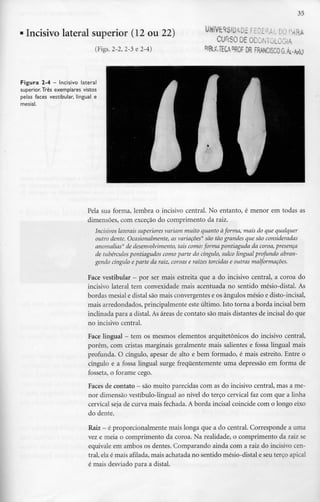 35
• Incisivo lateral superior (12 ou 22) UNIVÊWDADS f oo PARA
CURSO DE ODONTOLOGIA
(Figs. 2-2,2-3 e 2-4) RfeTECA °ROF OR FRANCISCOG. Ái-
Figura 2-4 - Incisivo lateral
superior. Três exemplares vistos
pelas faces vestibular, lingual e
mesial.
Pela sua forma, lembra o incisivo central. No entanto, é menor em todas as
dimensões, com exceção do comprimento da raiz.
Incisivos lateraissuperiores variam muito quanto àforma, mais do que qualquer
outro dente. Ocasionalmente, as variações* são tão grandes que sãoconsideradas
anomalias* de desenvolvimento, tais como: forma pontiaguda da coroa,presença
de tubérculospontiagudos como parte do ângulo, sulco lingualprofundo abran-
gendo ângulo eparte da raiz, coroas e raízes torcidas e outras malformações.
Face vestibular - por ser mais estreita que a do incisivo central, a coroa do
incisivo lateral tem convexidade mais acentuada no sentido mésio-distal. As
bordas mesial e distai são mais convergentese os ângulos mésio e disto-incisal,
mais arredondados, principalmente este último. Isto torna a borda incisai bem
inclinada para a distai. Asáreas de contato são mais distantes de incisai do que
no incisivo central.
Face lingual - tem os mesmos elementos arquitetônicos do incisivo central,
porém, com cristas marginais geralmente mais salientes e fossa lingual mais
profunda. O cíngulo, apesar de alto e bem formado, é mais estreito. Entre o
cíngulo e a fossa lingual surge frequentemente uma depressão em forma de
fosseta, o forame cego.
Faces de contato - são muito parecidas com as do incisivo central, mas ame-
nor dimensão vestíbulo-lingual ao nível do terço cervical faz com que a linha
cervical seja de curva mais fechada.A borda incisai coincide com o longo eixo
do dente.
Raiz - é proporcionalmente mais longa que a do central. Corresponde a uma
vez e meia o comprimento da coroa. Na realidade, o comprimento da raiz se
equivale em ambos os dentes. Comparando ainda com a raiz do incisivo cen-
tral, ela é mais afilada, mais achatada no sentido mésio-distal e seu terço apical
é mais desviado para a distai.
 