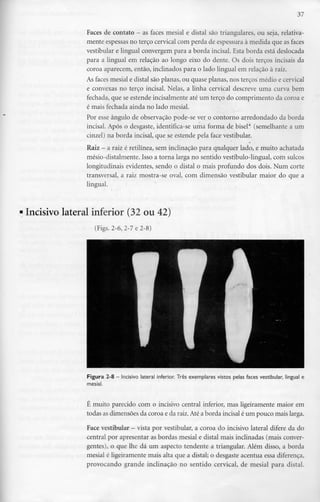 37
Faces de contato - as faces mesial e distai são triangulares, ou seja, relativa-
mente espessas no terço cervical com perda de espessura à medida que as faces
vestibular e lingual convergem para a borda incisai. Esta borda está deslocada
para a lingual em relação ao longo eixo do dente. Os dois terços incisais da
coroa aparecem, então, inclinados para o lado lingual em relação à raiz.
As faces mesial e distai são planas, ou quase planas, nos terços médio ecervical
e convexas no terço incisai. Nelas, a linha cervical descreve uma curva bem
fechada, que se estende incisalmente até um terço do comprimento da coroa e
é mais fechada ainda no lado mesial.
Por esse ângulo de observação pode-se ver o contorno arredondado da borda
incisai. Após o desgaste, identifica-se uma forma de bisel* (semelhante a um
cinzel) na borda incisai, que se estende pela face vestibular.
Raiz - a raiz é retilínea, sem inclinação para qualquer lado, e muito achatada
mésio-distalmente. Isso a torna larga no sentido vestíbulo-lingual, com sulcos
longitudinais evidentes, sendo o distai o mais profundo dos dois. Num corte
transversal, a raiz mostra-se oval, com dimensão vestibular maior do que a
lingual.
Incisivo lateral inferior (32 ou 42)
• (Figs. 2-6, 2-7 e 2-8)
Figura 2-8 - Incisivo lateral inferior. Três exemplares vistos pelas faces vestibular, lingual e
mesial.
É muito parecido com o incisivo central inferior, mas ligeiramente maior em
todas as dimensões da coroa e da raiz.Até a borda incisai é um pouco mais larga.
Face vestibular - vista por vestibular, a coroa do incisivo lateral difere da do
central por apresentar as bordas mesial e distai mais inclinadas (mais conver-
gentes), o que lhe dá um aspecto tendente a triangular. Além disso, a borda
mesial é ligeiramente mais alta que a distai; o desgaste acentua essa diferença,
provocando grande inclinação no sentido cervical, de mesial para distai.
 